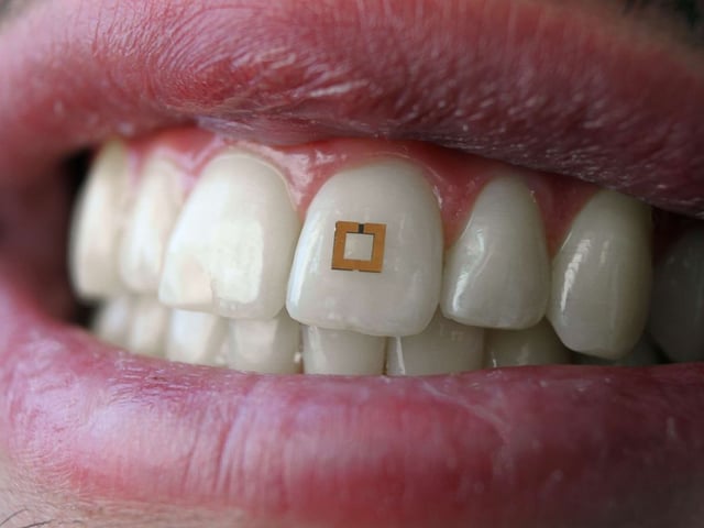 Tooth Sensor